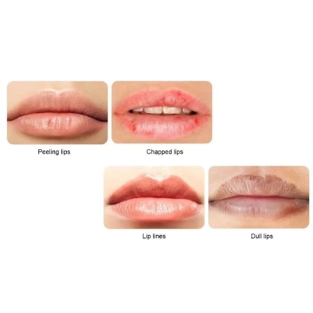 Maseczka na USTA Żelowa ALOE VERA - 20 szt.