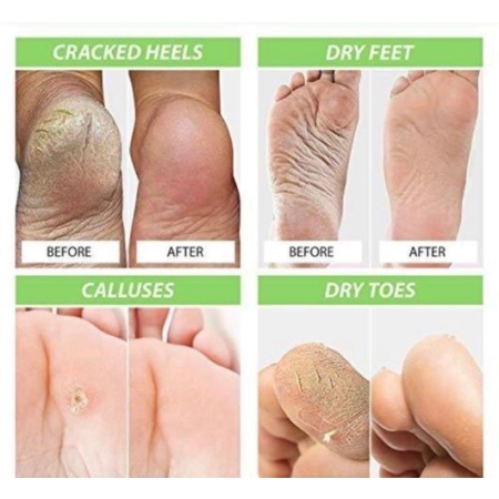 Krem do PIĘT na Szorstkie-Suche i Pękające Stopy HEEL BALM- Herbal Skin Doctor - 75g