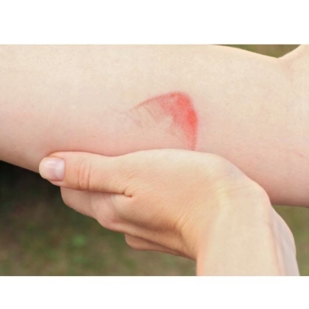 Krem na Blizny po Oparzeniach Oryginalna Receptura - 50g