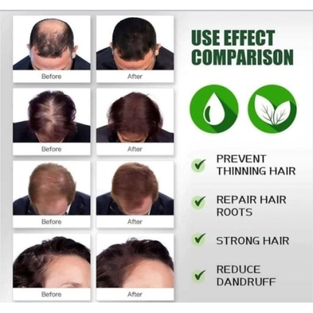 Olejek Arganowy na Porost Włosów - 80ml